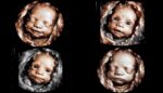 Baby's First Expressions: An Emotional Rollercoaster in a Cot - Nursing ...